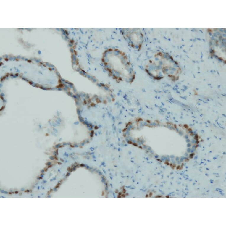 Immunohistochemistry - Anti-p63 Antibody - Antibodies.com (A8232)