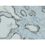 Immunohistochemistry - Anti-p63 Antibody - Antibodies.com (A8232)