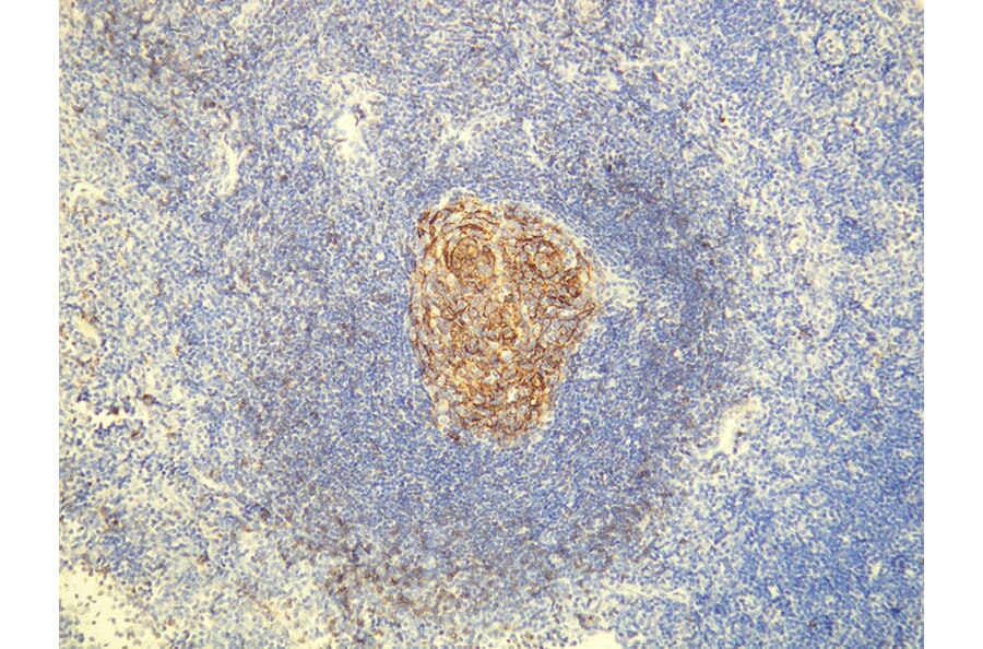 Immunohistochemistry - Anti-CD23 Antibody - Antibodies.com (A8233)