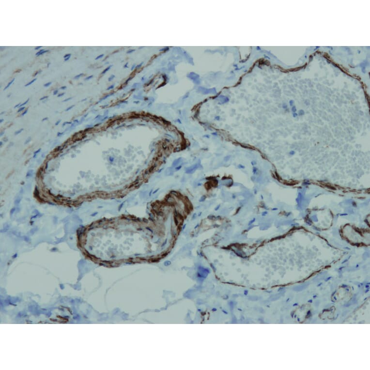 Immunohistochemistry - Anti-alpha Smooth Muscle Actin Antibody - Antibodies.com (A8234)