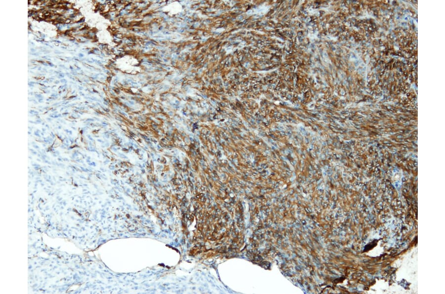 Immunohistochemistry - Anti-CD34 Antibody - Antibodies.com (A8236)
