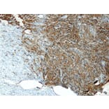 Immunohistochemistry - Anti-CD34 Antibody - Antibodies.com (A8236)