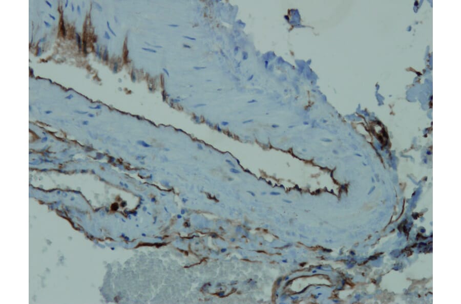 Immunohistochemistry - Anti-CD34 Antibody - Antibodies.com (A8236)
