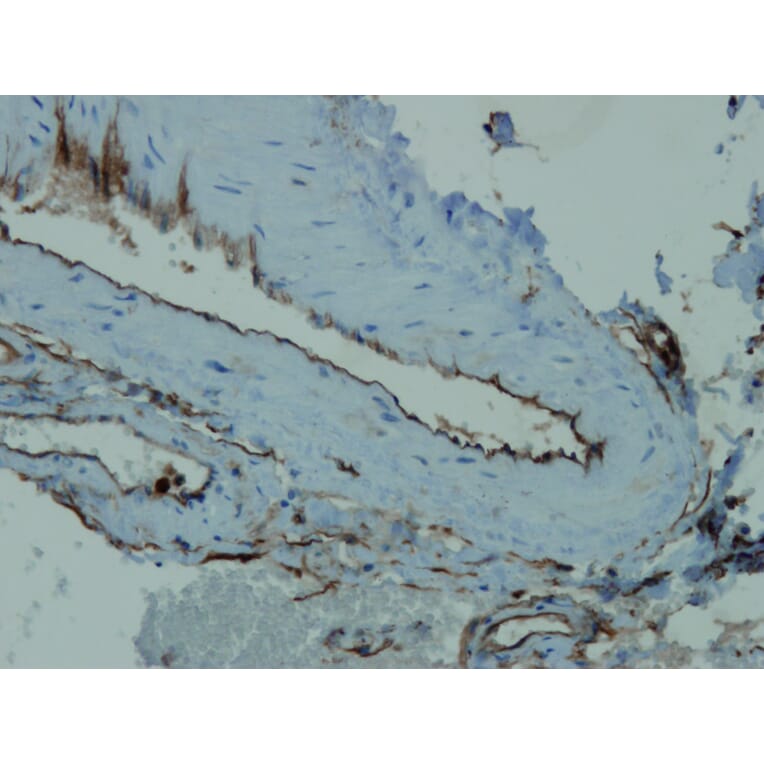 Immunohistochemistry - Anti-CD34 Antibody - Antibodies.com (A8236)