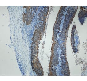 Immunohistochemistry - Anti-p16 Antibody - Antibodies.com (A8237)