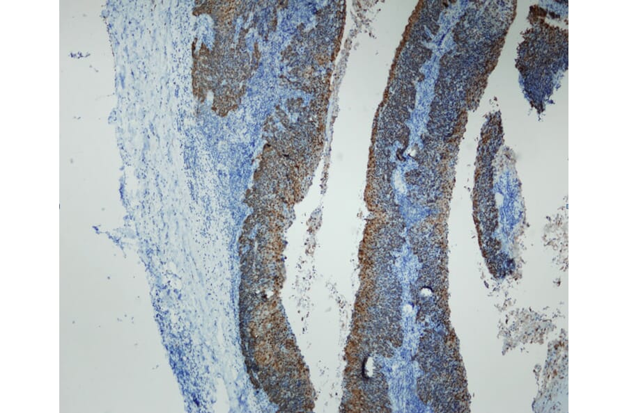 Immunohistochemistry - Anti-p16 Antibody - Antibodies.com (A8237)