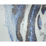Immunohistochemistry - Anti-p16 Antibody - Antibodies.com (A8237)