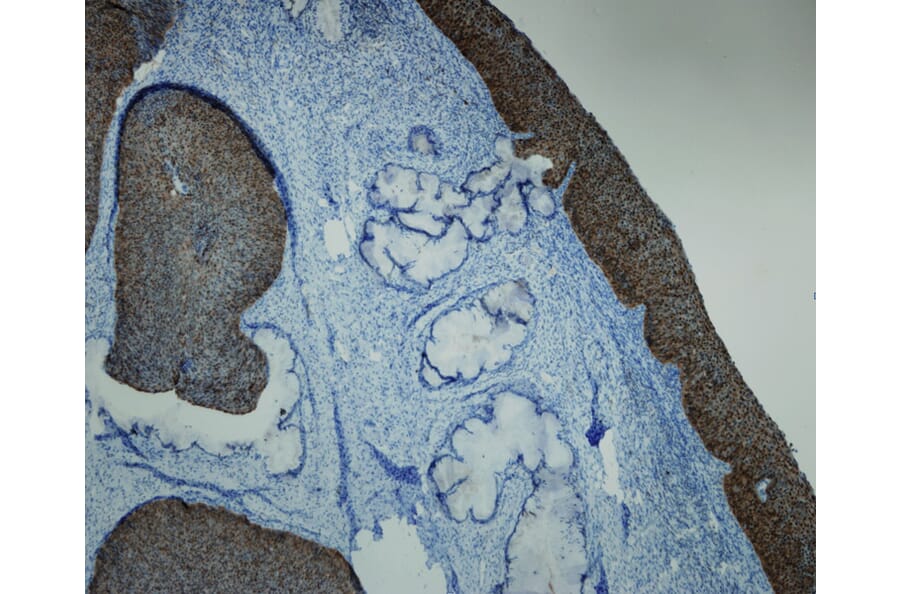 Immunohistochemistry - Anti-p16 Antibody - Antibodies.com (A8237)