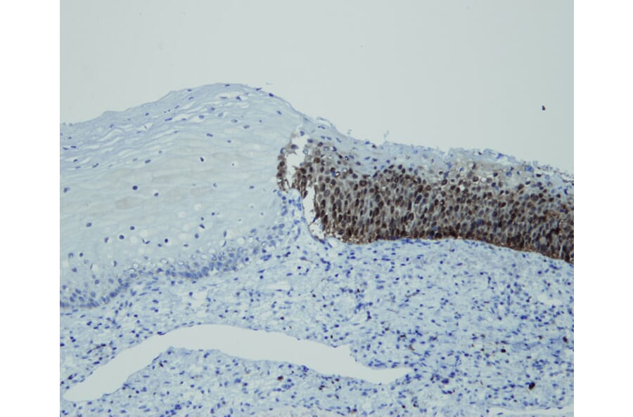Immunohistochemistry - Anti-p16 Antibody - Antibodies.com (A8237)