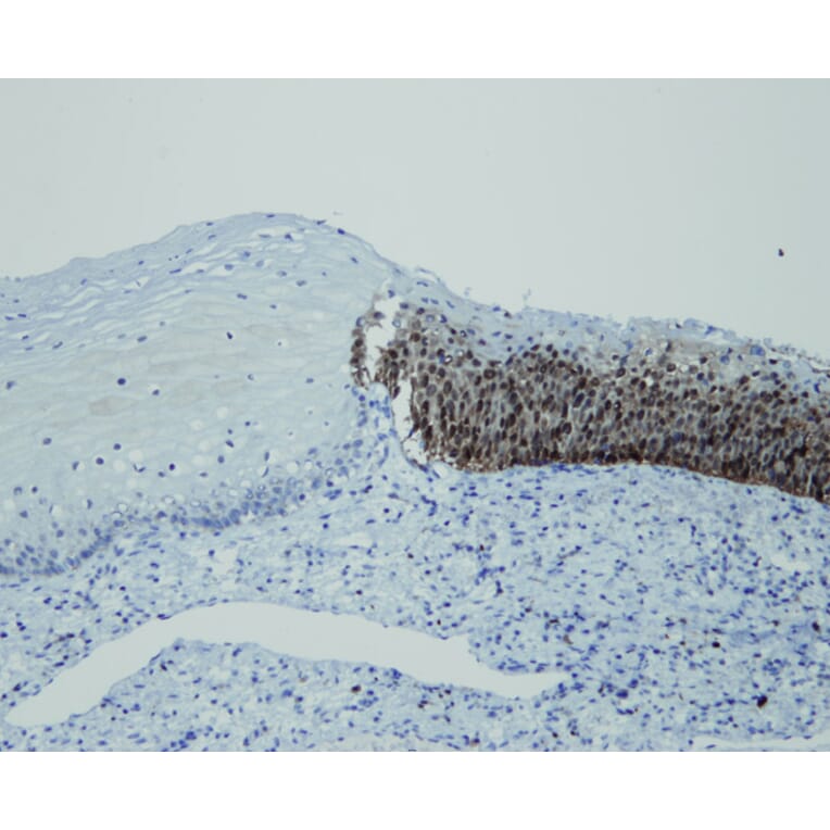 Immunohistochemistry - Anti-p16 Antibody - Antibodies.com (A8237)