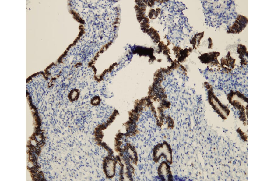 Immunohistochemistry - Anti-p16 Antibody - Antibodies.com (A8237)