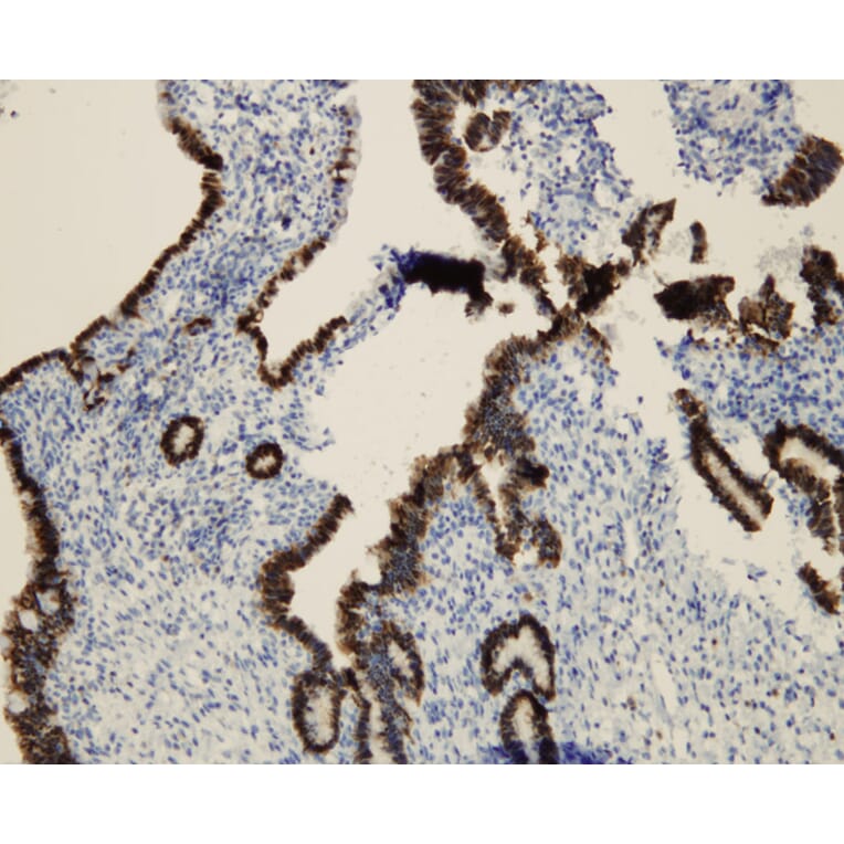 Immunohistochemistry - Anti-p16 Antibody - Antibodies.com (A8237)
