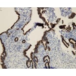 Immunohistochemistry - Anti-p16 Antibody - Antibodies.com (A8237)