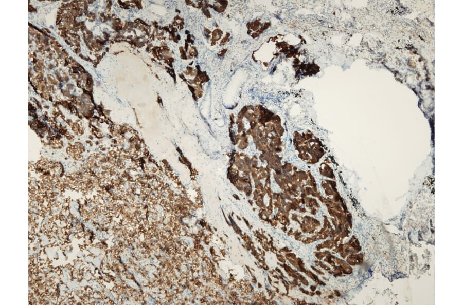 Immunohistochemistry - Anti-Synaptophysin Antibody - Antibodies.com (A8238)