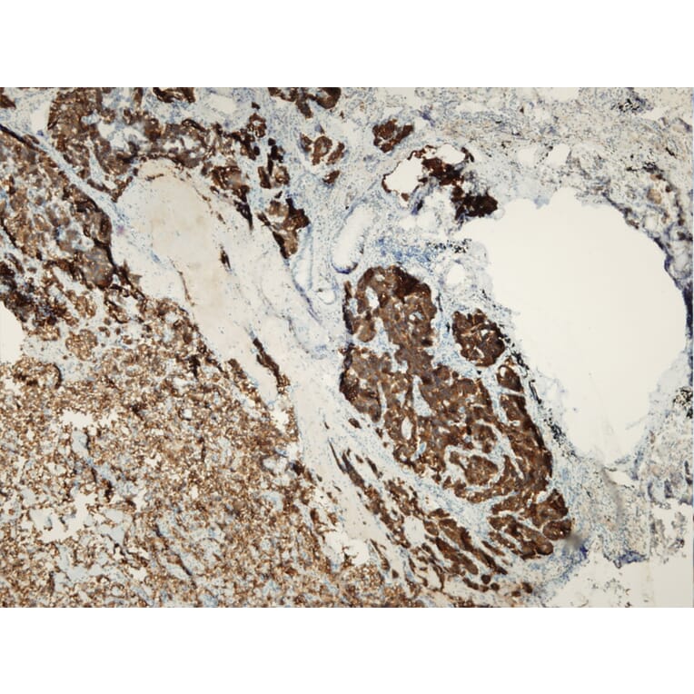 Immunohistochemistry - Anti-Synaptophysin Antibody - Antibodies.com (A8238)