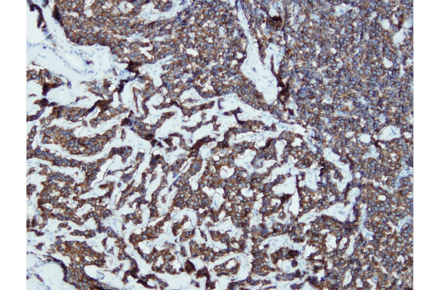 Immunohistochemistry - Anti-Synaptophysin Antibody - Antibodies.com (A8238)