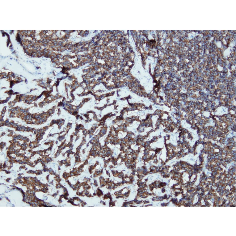 Immunohistochemistry - Anti-Synaptophysin Antibody - Antibodies.com (A8238)