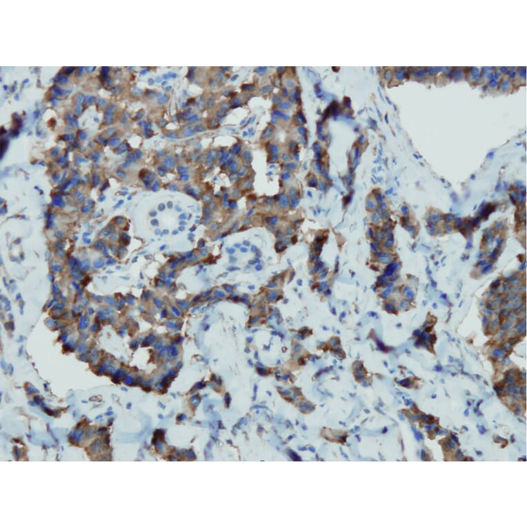 Immunohistochemistry - Anti-Chromogranin A Antibody - Antibodies.com (A8239)