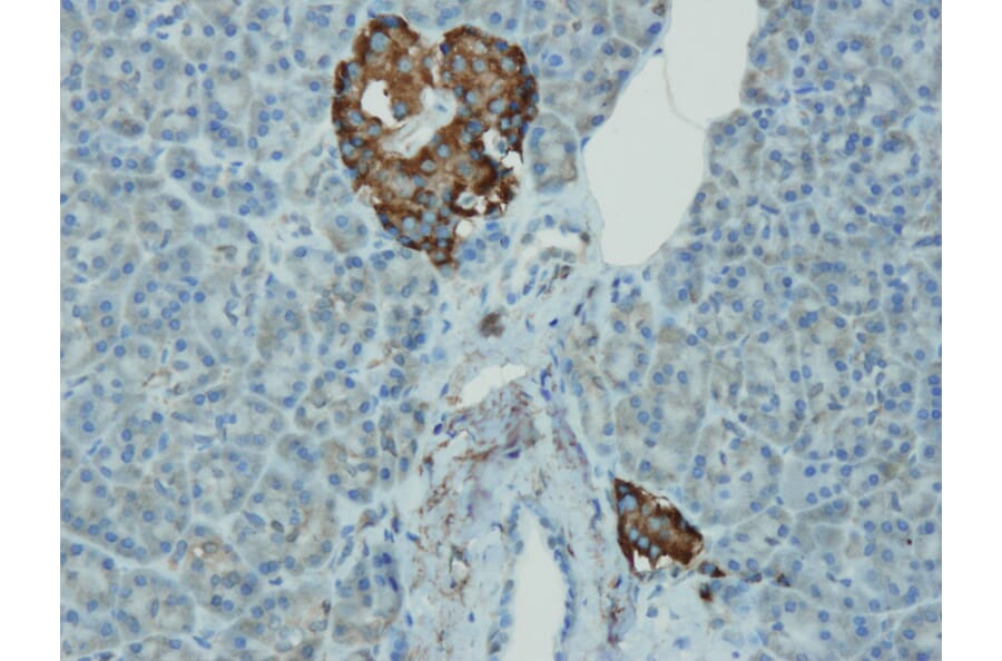 Immunohistochemistry - Anti-Chromogranin A Antibody - Antibodies.com (A8240)