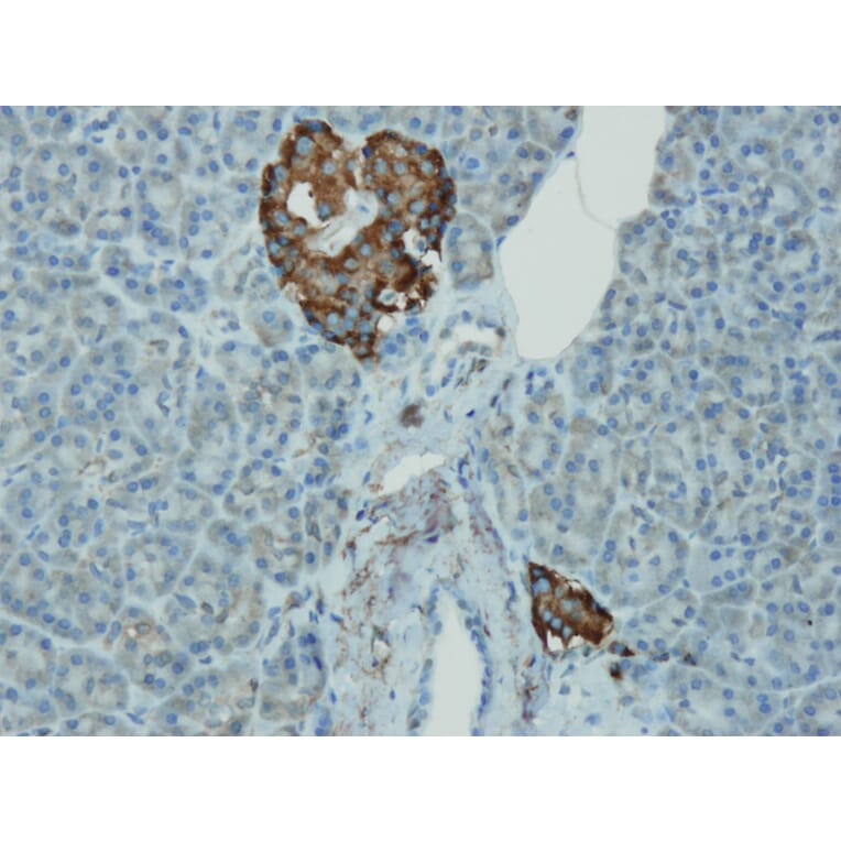 Immunohistochemistry - Anti-Chromogranin A Antibody - Antibodies.com (A8240)