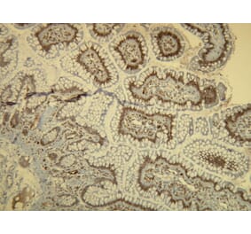 Immunohistochemistry - Anti-B-raf Antibody - Antibodies.com (A8241)