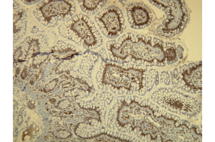 Immunohistochemistry - Anti-B-raf Antibody - Antibodies.com (A8241)