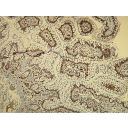 Immunohistochemistry - Anti-B-raf Antibody - Antibodies.com (A8241)