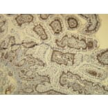 Immunohistochemistry - Anti-B-raf Antibody - Antibodies.com (A8241)