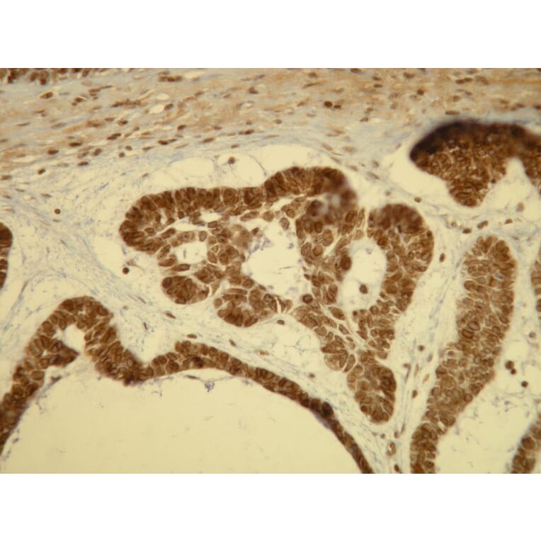 Immunohistochemistry - Anti-B-raf Antibody - Antibodies.com (A8241)