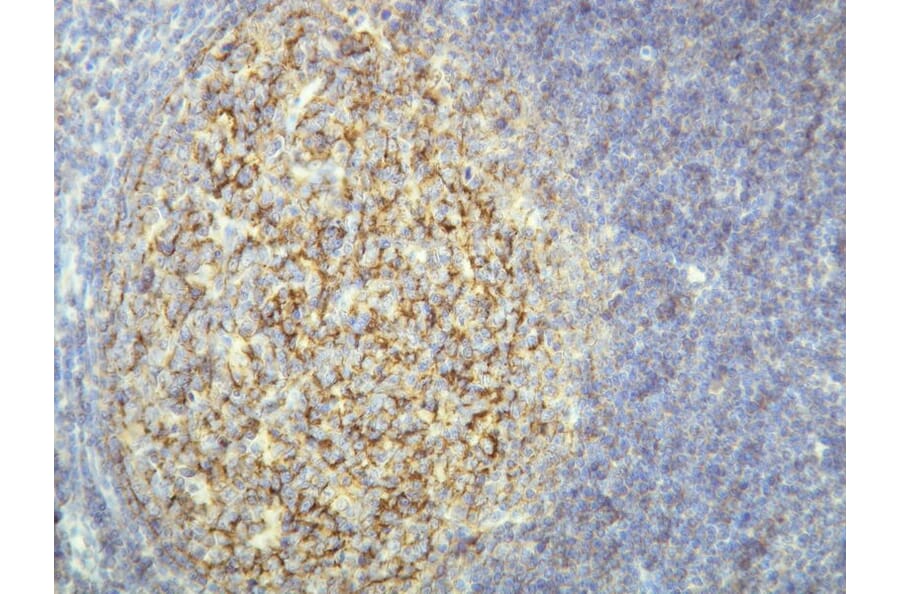 Immunohistochemistry - Anti-CD21 Antibody - Antibodies.com (A8246)