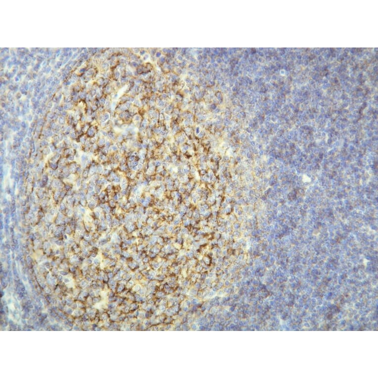 Immunohistochemistry - Anti-CD21 Antibody - Antibodies.com (A8246)