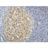 Immunohistochemistry - Anti-CD21 Antibody - Antibodies.com (A8246)