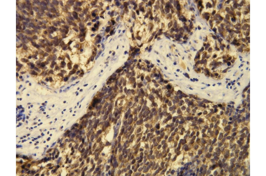 Immunohistochemistry - Anti-CD57 Antibody - Antibodies.com (A8247)
