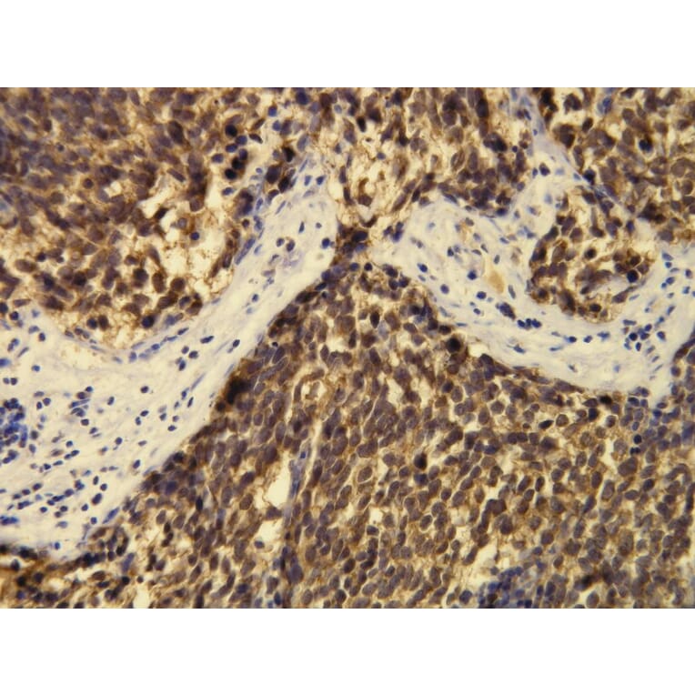 Immunohistochemistry - Anti-CD57 Antibody - Antibodies.com (A8247)