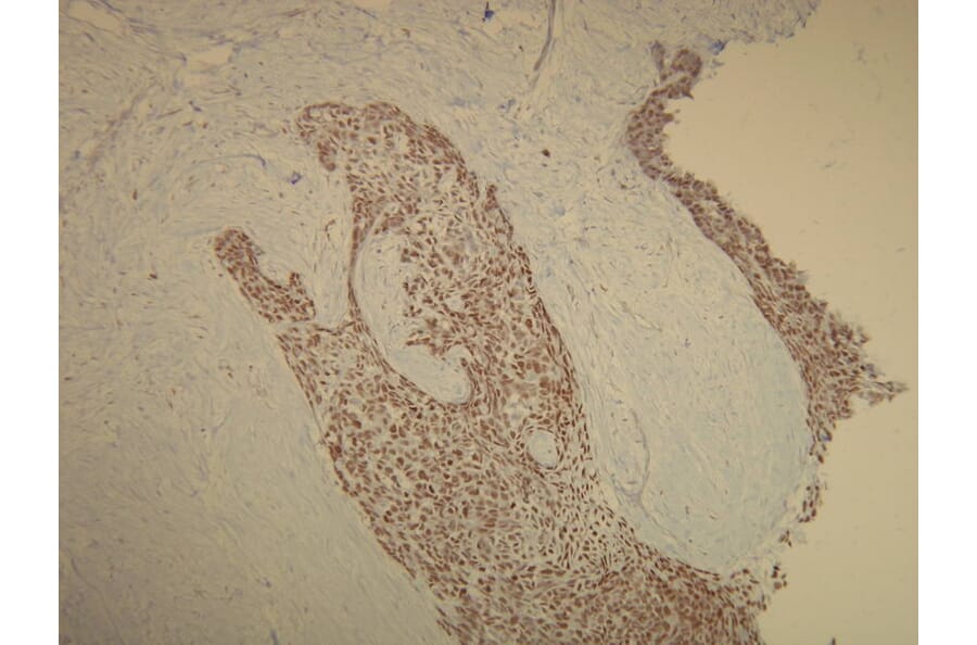 Immunohistochemistry - Anti-p63 Antibody - Antibodies.com (A8248)