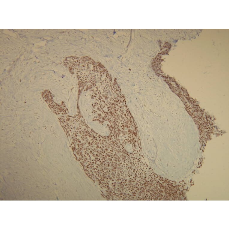 Immunohistochemistry - Anti-p63 Antibody - Antibodies.com (A8248)