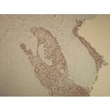 Immunohistochemistry - Anti-p63 Antibody - Antibodies.com (A8248)