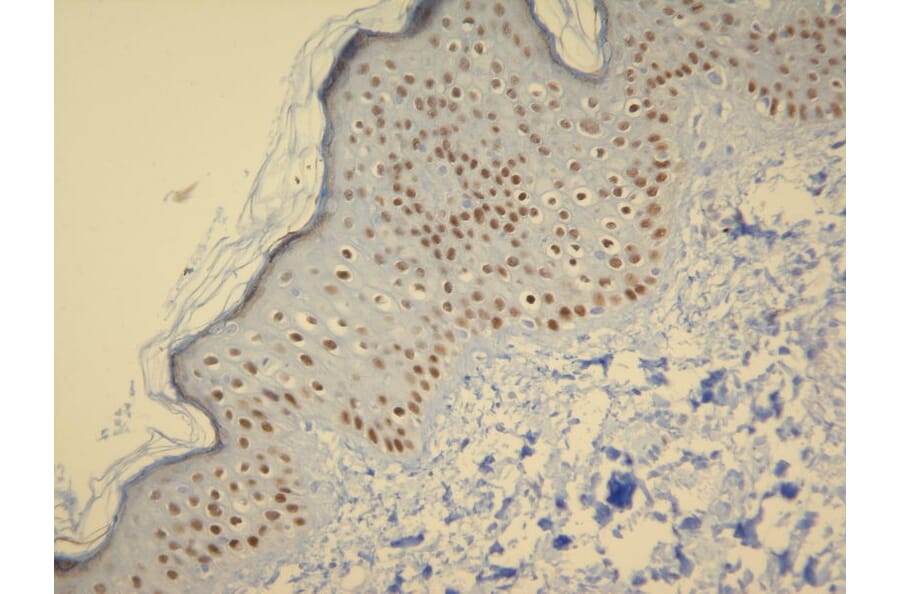 Immunohistochemistry - Anti-p63 Antibody - Antibodies.com (A8248)