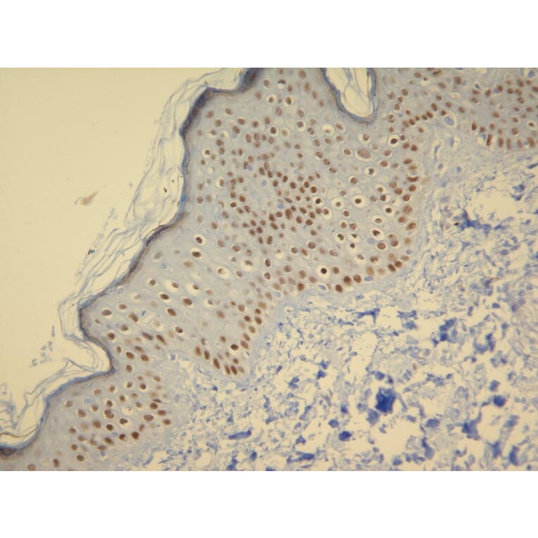 Immunohistochemistry - Anti-p63 Antibody - Antibodies.com (A8248)