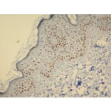 Immunohistochemistry - Anti-p63 Antibody - Antibodies.com (A8248)