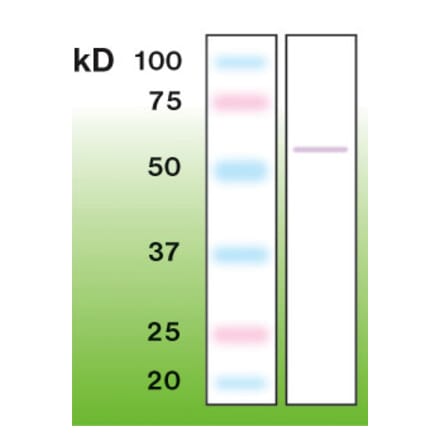 Western Blot - Anti-p53 Antibody - Antibodies.com (A8251)