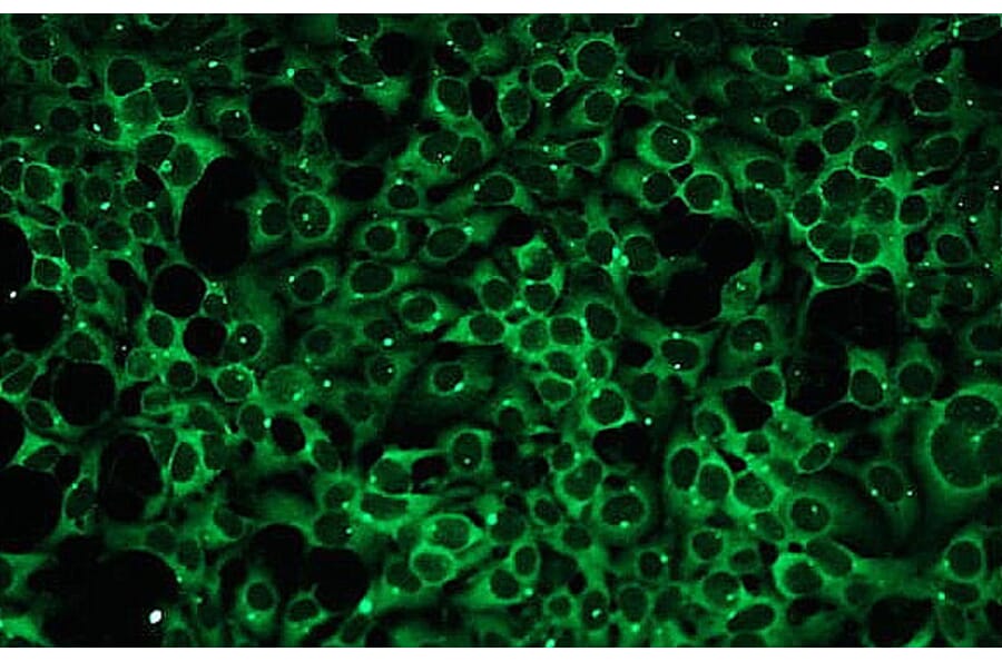 Immunocytochemistry - Anti-PKC beta I Antibody - Antibodies.com (A8254)