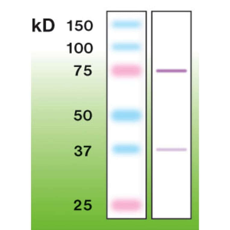 Western Blot - Anti-PKC beta Antibody - Antibodies.com (A8255)
