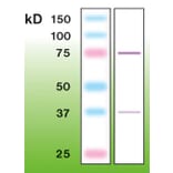 Western Blot - Anti-PKC beta Antibody - Antibodies.com (A8255)