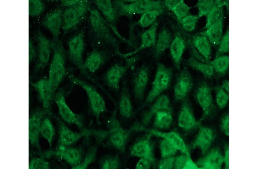 Immunocytochemistry - Anti-PKC beta Antibody - Antibodies.com (A8255)