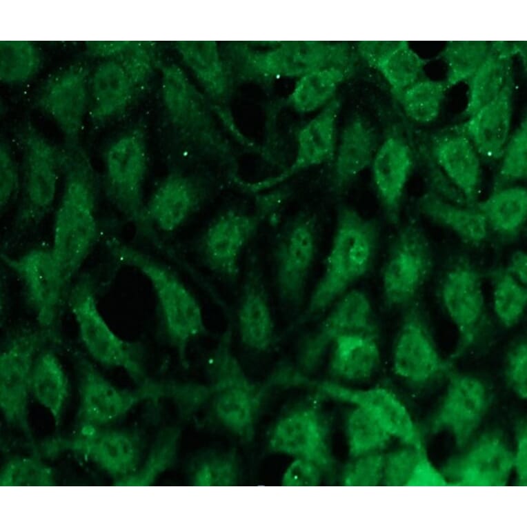 Immunocytochemistry - Anti-PKC beta Antibody - Antibodies.com (A8255)