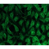 Immunocytochemistry - Anti-PKC beta Antibody - Antibodies.com (A8255)