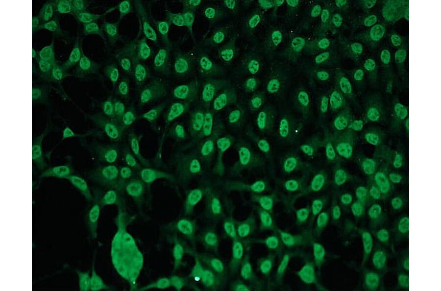 Immunocytochemistry - Anti-PKC gamma Antibody - Antibodies.com (A8256)
