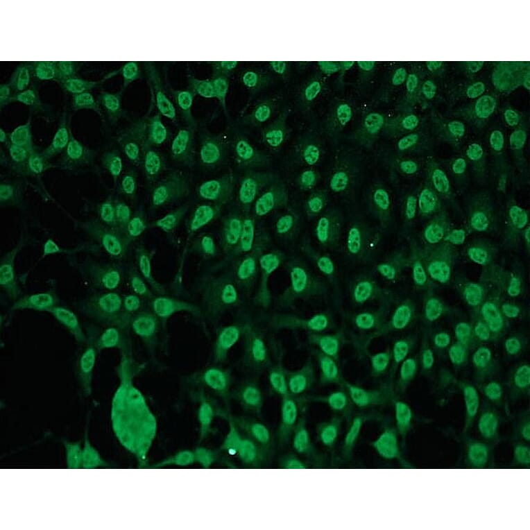 Immunocytochemistry - Anti-PKC gamma Antibody - Antibodies.com (A8256)