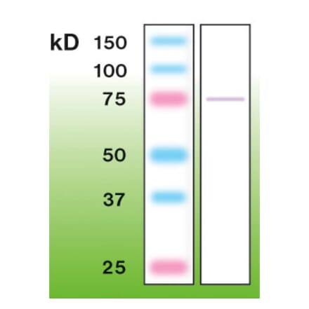 Western Blot - Anti-PKC epsilon Antibody - Antibodies.com (A8258)